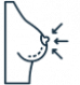 mamoplastia redutora